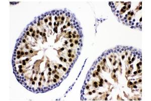 IHC analysis of KDM5B using anti-KDM5B antibody (ABIN4886648). (KDM5B anticorps  (Middle Region))