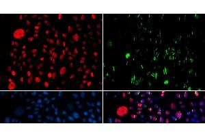 Immunofluorescence analysis of GFP-RNF168 transgenic U2OS cells using Phospho-SMC1A(S957) Polyclonal Antibody (SMC1A anticorps  (pSer957))