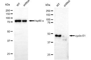 anti-Cyclin E1 (CCNE1) antibody