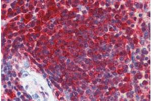 Anti-ENO1 antibody IHC staining of human spleen.