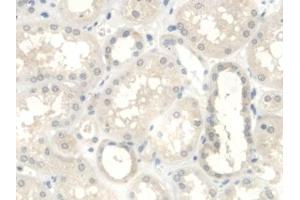 Detection of UGCG in Human Kidney Tissue using Polyclonal Antibody to UDP Glucose Ceramide Glucosyltransferase (UGCG)