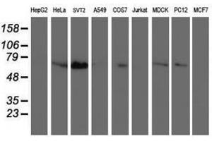 anti-Schwannomin Interacting Protein 1 (SCHIP1) antibody
