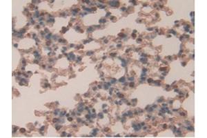 IHC-P analysis of Mouse Lung Tissue, with DAB staining. (Retinoic Acid Receptor alpha anticorps  (AA 237-459))