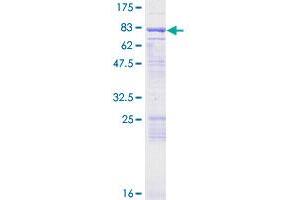 Image no. 1 for Ectodermal-Neural Cortex 1 (With BTB-Like Domain) (ENC1) (AA 1-589) protein (GST tag) (ABIN1352785)