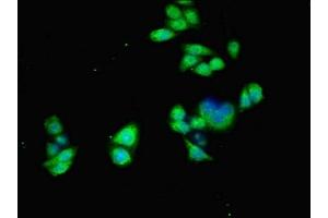 Immunofluorescent analysis of PC-3 cells using ABIN7143174 at dilution of 1:100 and Alexa Fluor 488-congugated AffiniPure Goat Anti-Rabbit IgG(H+L)