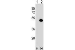 Western blot analysis of ASS1 antibody and 293 cell lysate either nontransfected (Lane 1) or transiently transfected (2) with the ASS1 gene.
