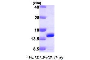 SDS-PAGE (SDS) image for DnaJ (Hsp40) Homolog, Subfamily C, Member 19 (DNAJC19) (AA 19-116) protein (His tag) (ABIN667349)