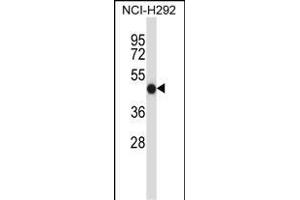 FCGR2A Antibody (C-term) (ABIN657646 and ABIN2846641) western blot analysis in NCI- cell line lysates (35 μg/lane). (FCGR2A anticorps  (C-Term))