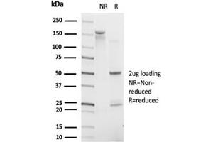 SDS-PAGE Analysis. (IRF9 anticorps)