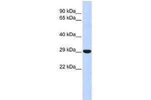 WB Suggested Anti-HOXB8 Antibody Titration: 0. (HOXB8 anticorps  (N-Term))