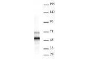 MEIS 1/2/3 antibody (rAb) tested by Western blot. (Recombinant MEIS1/MEIS2/MEIS3 (AA 59-390) anticorps)