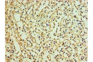 Immunohistochemistry of paraffin-embedded human spleen tissue using ABIN7151129 at dilution of 1:100 (RNF125 anticorps  (AA 1-232))