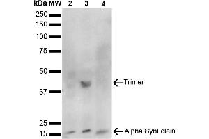 Western Blot analysis of Human, Mouse, Rat Brain showing detection of 14 kDa Alpha Synuclein protein using Mouse Anti-Alpha Synuclein Monoclonal Antibody, Clone 10H7 (ABIN5564071). (SNCA anticorps)