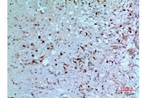 Immunohistochemistry (IHC) analysis of paraffin-embedded Human Brain, antibody was diluted at 1:100.