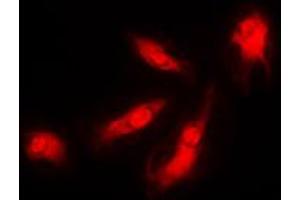 Immunofluorescent analysis of p35 staining in HeLa cells. (CDK5R1 anticorps  (N-Term))