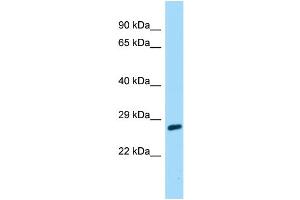Host: Rabbit Target Name: CABP7 Sample Type: 721_B Whole Cell lysates Antibody Dilution: 1. (CABP7 anticorps  (C-Term))
