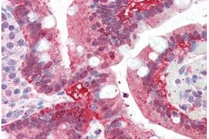 Human Small Intestine (formalin-fixed, paraffin-embedded) stained with AKR1C3 antibody ABIN343889 at 5 ug/ml followed by biotinylated anti-goat IgG secondary antibody ABIN481715, alkaline phosphatase-streptavidin and chromogen. (AKR1C3 anticorps  (AA 311-323))