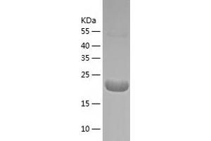 Western Blotting (WB) image for Ubiquitin-Conjugating Enzyme E2G 2 (UBE2G2) (AA 1-165) protein (His-IF2DI Tag) (ABIN7125618)