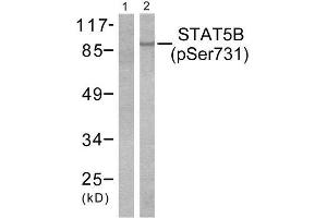 Western Blotting (WB) image for anti-Signal Transducer and Activator of Transcription 5B (STAT5B) (pSer731) antibody (ABIN1847250) (STAT5B anticorps  (pSer731))