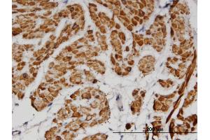 Immunoperoxidase of monoclonal antibody to TPM2 on formalin-fixed paraffin-embedded human smooth muscle.