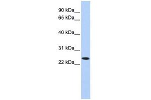 KLRA1 antibody used at 1 ug/ml to detect target protein. (KLRA1 anticorps  (N-Term))