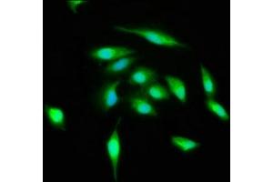 Immunofluorescence staining of Hela cells with ABIN7174567 at 1:400, counter-stained with DAPI. (ATG3 anticorps  (AA 1-314))