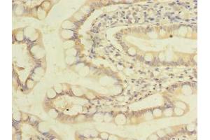 Immunohistochemistry of paraffin-embedded human small intestine tissue using ABIN7162550 at dilution of 1:100 (ZDHHC3 anticorps  (AA 94-171))