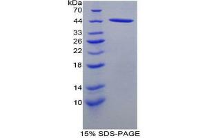 SDS-PAGE (SDS) image for Chemokine (C-C Motif) Ligand 21 (CCL21) (AA 5-132) protein (His tag,GST tag) (ABIN1879007)