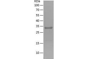 Western Blotting (WB) image for Zinc Finger Protein 306 (ZKSCAN3) (AA 1-248) protein (His tag) (ABIN7125784)