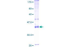 Image no. 1 for ATPase, Na+/K+ Transporting, alpha 4 Polypeptide (ATP1A4) (AA 1-165) protein (GST tag) (ABIN1346021)
