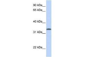 UCK2 antibody used at 1 ug/ml to detect target protein.