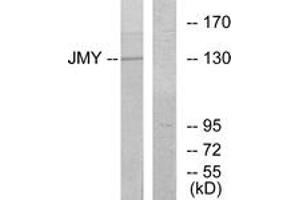 Western blot analysis of extracts from COLO cells, using JMY Antibody. (JMY anticorps  (AA 931-980))