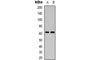 Western blot analysis of CD19 expression in Jurkat (A), mouse brain (B) whole cell lysates. (CD19 anticorps)