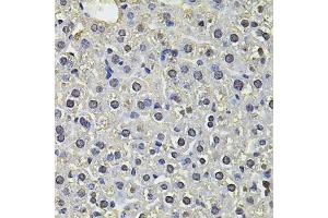 Immunohistochemistry of paraffin-embedded mouse liver using SP110 Antibody (ABIN6290941) at dilution of 1:100 (40x lens). (SP110 anticorps)