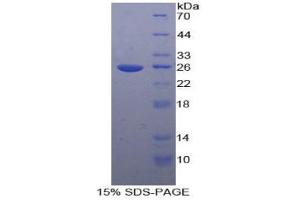 SDS-PAGE analysis of Human TICAM2 Protein. (ICAM2 Protéine)