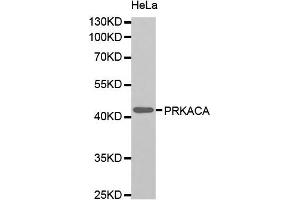 Western blot analysis of extracts of HeLa cell line, using PRKACA antibody.
