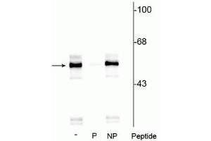 Western blot of rat brainstem lysate showing specific immunolabeling of the ~55 kDa TPH protein phosphorylated at Ser260 in lane one (-). (Tryptophan Hydroxylase 1 anticorps  (pSer260))