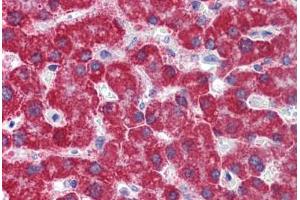 Human Liver: Formalin-Fixed, Paraffin-Embedded (FFPE)