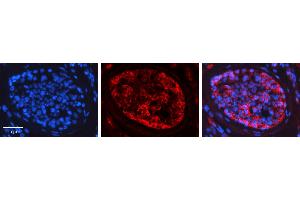 Rabbit Anti-PRKCZ Antibody   Formalin Fixed Paraffin Embedded Tissue: Human Testis Tissue Observed Staining: Cytoplasm Primary Antibody Concentration: 1:600 Other Working Concentrations: N/A Secondary Antibody: Donkey anti-Rabbit-Cy3 Secondary Antibody Concentration: 1:200 Magnification: 20X Exposure Time: 0. (PKC zeta anticorps  (N-Term))