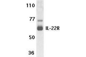 Western blot analysis of IL-22 receptor expression in human HepG2 cell lysate with AP30417PU-N IL-22 receptor antibody at 1 μg /ml. (IL22 Receptor alpha 1 anticorps  (N-Term))