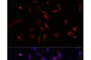 Immunofluorescence analysis of NIH/3T3 cells using c-Fos Polyclonal Antibody at dilution of 1:100.