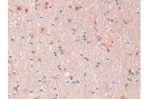 Detection of a1AT in Human Liver Tissue using Polyclonal Antibody to Alpha-1-Antitrypsin (a1AT)