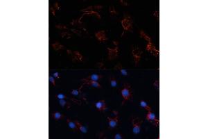 Immunofluorescence analysis of C6 cells using Src antibody (ABIN6132240, ABIN6148428, ABIN6148429 and ABIN6215399) at dilution of 1:100.