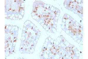 Formalin-fixed, paraffin-embedded human Colon stained with CD103 Mouse Monoclonal Antibody (ITGAE/2474).