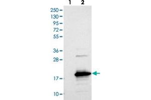 Western blot analysis of Lane 1: Negative control (vector only transfected HEK293T lysate), Lane 2: Over-expression Lysate (Co-expressed with a C-terminal myc-DDK tag (~3. (SAMD12 anticorps)