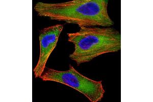 Immunofluorescent analysis of 4 % paraformaldehyde-fixed, 0.