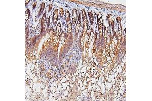 IHC analysis of TDRD3 using anti-TDRD3 antibody (ABIN6719636).