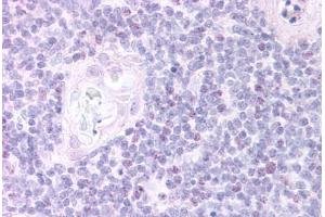 Human Thymus, Medulla (formalin-fixed, paraffin-embedded) stained with FOXN1 antibody ABIN297057 at 20 ug/ml followed by biotinylated anti-goat IgG secondary antibody ABIN481715, alkaline phosphatase-streptavidin and chromogen. (FOXN1 anticorps  (AA 635-648))