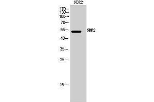 Western Blotting (WB) image for anti-serine/threonine Kinase 38 Like (STK38L) (C-Term) antibody (ABIN3185788) (STK38L anticorps  (C-Term))