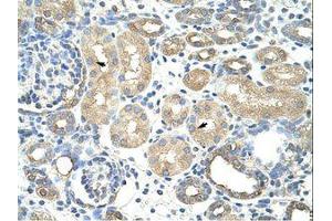 Image no. 1 for anti-Ribonucleoprotein, PTB-Binding 1 (RAVER1) (AA 24-73) antibody (ABIN202804) (RAVER1 anticorps  (AA 24-73))